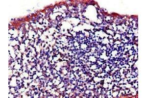 Immunohistochemistry of paraffin-embedded human tonsil tissue using ABIN7156864 at dilution of 1:100 (IL23R 抗体  (AA 15-125))