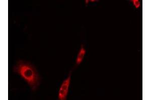 ABIN6275237 staining LOVO by IF/ICC. (MRPS30 抗体  (C-Term))