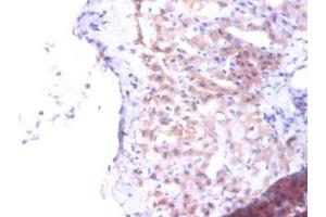 Immunohistochemistry of paraffin-embedded human liver tissue using ABIN7163250 at dilution of 1:100 (PTDSS1 抗体  (AA 1-35))