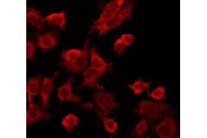 ABIN6277536 staining HeLa by IF/ICC. (LTBR 抗体  (N-Term))