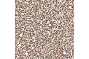 IHC analysis of Sm-D3/SNRPD3 using anti-Sm-D3/SNRPD3 antibody (ABIN7598952). (SNRPD3 抗体  (AA 1-112))