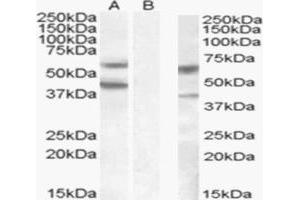 Western Blotting (WB) image for anti-Excision Repair Cross Complementing Polypeptide-1 (ERCC1) (N-Term) antibody (ABIN2156776) (ERCC1 抗体  (N-Term))