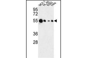 Western blot analysis of AIM2 Antibody (N-term) (ABIN653833 and ABIN2843099) in MCF-7, HL-60, K562, Hela cell line lysates (35 μg/lane). (AIM2 抗体  (N-Term))