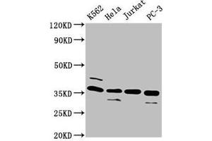 Western Blot Positive WB detected in: K562 whole cell lysate, Hela whole cell lysate, Jurkat whole cell lysate, PC-3 whole cell lysate All lanes: ATG3 antibody at 4 μg/mL Secondary Goat polyclonal to rabbit IgG at 1/50000 dilution Predicted band size: 36 kDa Observed band size: 36 kDa (ATG3 抗体  (AA 1-314))