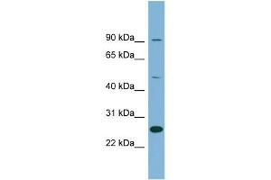 WB Suggested Anti-LRRC49 Antibody Titration: 0. (LRRC49 抗体  (N-Term))
