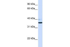 WB Suggested Anti-B3GALT1 Antibody Titration:  0. (B3GALT1 抗体  (N-Term))