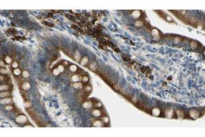 ABIN6276238 at 1/100 staining Mouse intestine tissue by IHC-P.