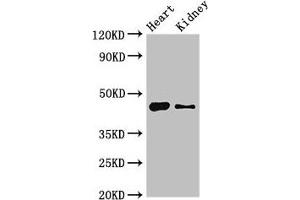 Western Blot Positive WB detected in: Mouse heart tissue, Mouse kidney tissue All lanes: MNDA antibody at 4 μg/mL Secondary Goat polyclonal to rabbit IgG at 1/50000 dilution Predicted band size: 46 kDa Observed band size: 46 kDa (MNDA 抗体  (AA 84-233))