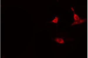 ABIN6274112 staining HeLa cells by IF/ICC. (BUB1B 抗体  (C-Term))