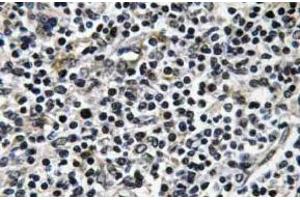 Immunohistochemistry (IHC) analyzes of p-ZAP-70 antibody in paraffin-embedded human thymus gland tissue. (ZAP70 抗体  (pTyr319))