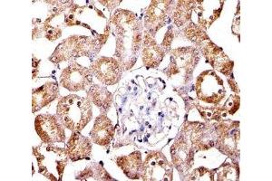 Immunohistochemical analysis of paraffin-embedded mouse kidney section using SPHK1 antibody; Ab was diluted at 1:100 dilution. (SPHK1 抗体  (AA 59-89))