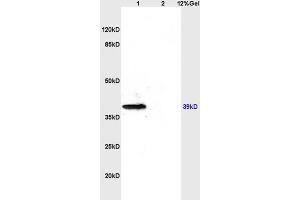 L1 rat brain lysates L2 rat kidney lysates probed with Anti- CD184/CXCR4 Polyclonal Antibody, Unconjugated (ABIN730888) at 1:200 overnight at 4 °C. (CXCR4 抗体  (AA 201-294))