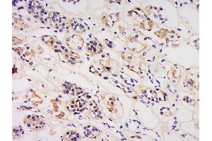 Paraformaldehyde-fixed, paraffin embedded human kidney, Antigen retrieval by boiling in sodium citrate buffer (pH6) for 15min, Block endogenous peroxidase by 3% hydrogen peroxide for 30 minutes, Blocking buffer (normal goat serum) at 37°C for 20min, Antibody incubation with 	Rabbit Anti-IL-3R alpha/CD123 Polyclonal Antibody, Unconjugated  at 1:200 overnight at 4°C, followed by a conjugated secondary and DAB staining. (IL3RA 抗体  (AA 201-300))