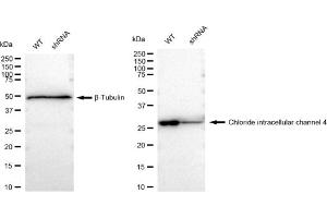 Western blotting analysis using Chloride intracellular channel 4 antibody (ABIN7798051).