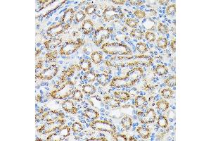 Immunohistochemistry of paraffin-embedded mouse kidney using NDUFS4 Rabbit mAb (ABIN7268821) at dilution of 1:100 (40x lens).