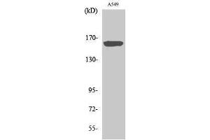 Western Blotting (WB) image for anti-Nitric Oxide Synthase 1, Neuronal (NOS1) (Thr175), (Tyr177) antibody (ABIN3185935) (NOS1 抗体  (Thr175, Tyr177))