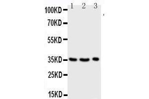 Anti-Granzyme A antibody, Western blotting Lane 1: JURKAT Cell Lysate Lane 2: CEM Cell Lysate Lane 3: RAJI Cell Lysate (GZMA 抗体  (Middle Region))