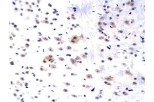 Formalin-fixed and paraffin embedded rat hippocampus labeled with Anti WIF1 Polyclonal Antibody, Unconjugated (ABIN751108) followed by conjugation to the secondary antibody and DAB staining (WIF1 抗体  (AA 51-150))