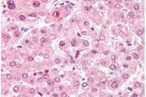 Human Liver: Formalin-Fixed, Paraffin-Embedded (FFPE) (COMT 抗体  (C-Term))