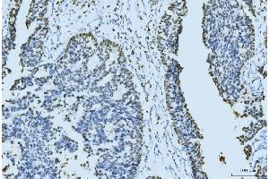 IHC analysis of MCM6 using anti-MCM6 antibody (ABIN7600037). (MCM6 抗体  (AA 14-821))