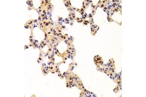 Immunohistochemistry of paraffin-embedded rat lung using ANP32A Antibody (ABIN5973390) at dilution of 1/100 (40x lens). (PHAP1 抗体)