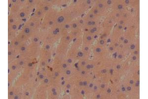 DAB staining on IHC-P; Samples: Human Liver Tissue (BMP1 抗体  (AA 610-843))