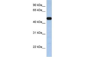 Western Blotting (WB) image for anti-Solute Carrier Family 25, Member 46 (SLC25A46) antibody (ABIN2458810) (SLC25A46 抗体)