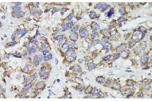 Immunohistochemistry (Paraffin-embedded Sections) (IHC (p)) image for anti-Succinate-CoA Ligase, GDP-Forming, beta Subunit (SUCLG2) antibody (ABIN7264719)