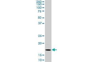 BATF monoclonal antibody (M01), clone 8A12. (BATF 抗体  (AA 34-125))