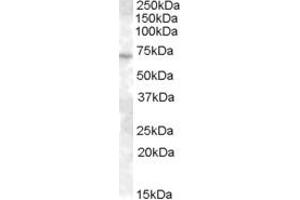 Western Blotting (WB) image for anti-ATP-Binding Cassette, Sub-Family E (OABP), Member 1 (ABCE1) (AA 579-590) antibody (ABIN292926)