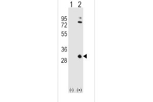 Western blot analysis of OA1 (arrow) using rabbit polyclonal OA1 Antibody (N-term) 7414a. (APOA1 抗体  (N-Term))