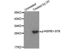 Western blot analysis of extracts from HL60 cells, using Phospho-HSPB1-S78 antibody (ABIN2987689). (HSP27 抗体  (pSer78))