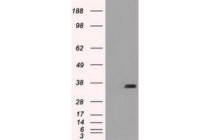 Image no. 1 for anti-Fc Fragment of IgG, Low Affinity IIa, Receptor (CD32) (FCGR2A) antibody (ABIN1497258) (FCGR2A 抗体)