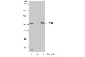 IP Image Immunoprecipitation of EPS8 protein from HepG2 whole cell extracts using 5 μg of EPS8 antibody [C3], C-term, Western blot analysis was performed using EPS8 antibody [C3], C-term, EasyBlot anti-Rabbit IgG  was used as a secondary reagent. (EPS8 抗体  (C-Term))