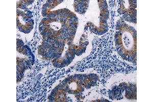 Immunohistochemistry (IHC) image for anti-Dual Specificity Phosphatase 6 (DUSP6) antibody (ABIN2428102) (DUSP6 抗体)
