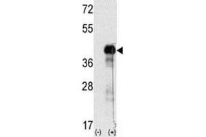 Western blot analysis of SOX-2 antibody and 293 cell lysate (2 ug/lane) either nontransfected (Lane 1) or transiently transfected with the SOX2 gene (2). (SOX2 抗体  (AA 89-119))
