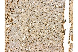 ABIN7094428 and ABIN7098476 at 1/100 staining Rat brain tissue by IHC-P. (GJB6 抗体  (C-Term))