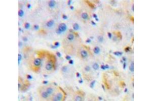 Used in DAB staining on fromalin fixed paraffin-embedded Liver tissue (MST1R 抗体  (AA 1092-1316))