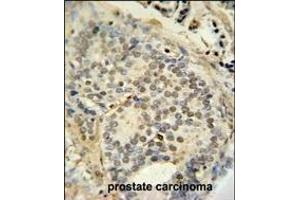 Immunohistochemistry (Paraffin-embedded Sections) (IHC (p)) image for anti-Fused in Sarcoma (FUS) (AA 499-526), (C-Term) antibody (ABIN654146)
