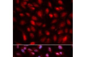 Immunofluorescence analysis of U2OS cells using SUMO2 Polyclonal Antibody (SUMO2 抗体)