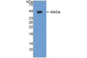 Detection of Recombinant RAD51, Human using Polyclonal Antibody to RAD51 Homolog (RAD51) (RAD51 Homolog 抗体  (AA 2-339))