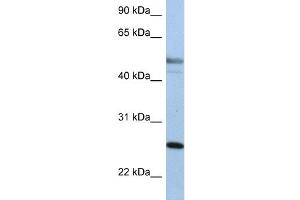 WB Suggested Anti-KRT8 Antibody Titration:  0.