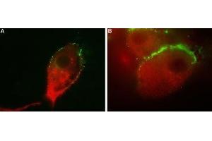 Colocalization of GluR1 and Vesicular GABA Transporter in human U-87 MG cells - Immunocytochemical staining of human glioblastoma U-87 MG. (SLC32A1 抗体  (Cytosolic, N-Term))