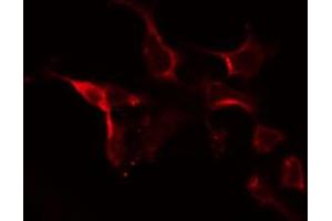 ABIN6274726 staining 293 by IF/ICC. (MRPL10 抗体  (C-Term))