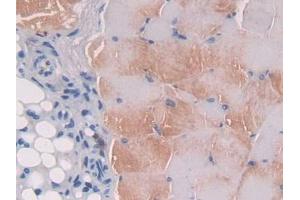 IHC-P analysis of Mouse Skeletal muscle Tissue, with DAB staining. (IL12B 抗体  (AA 35-302))