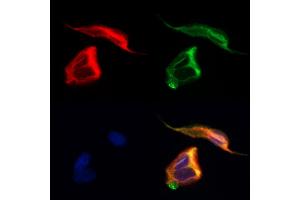 ABIN7094145 and ABIN7098189 staining Hela cells by IF/ICC. (DPYSL5 抗体  (C-Term))