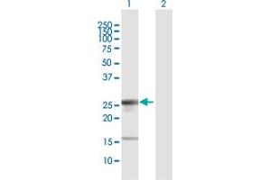Western Blot analysis of LIN28 expression in transfected 293T cell line by LIN28 MaxPab polyclonal antibody. (LIN28A 抗体  (AA 1-209))