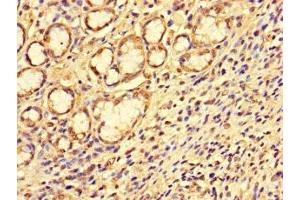 Immunohistochemistry (IHC) image for anti-Synovial Sarcoma Translocation Gene On Chromosome 18-Like 1 (SS18L1) (AA 47-396) antibody (ABIN7146400)