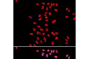 Immunofluorescence (IF) image for anti-Dyskeratosis Congenita 1, Dyskerin (DKC1) antibody (ABIN7259883)