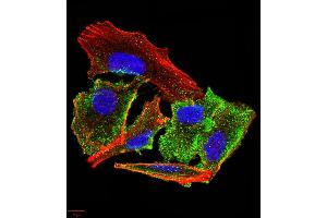 Immunocytochemistry (ICC) image for anti-Transthyretin (TTR) (AA 1-147) antibody (ABIN5875576) (TTR 抗体  (AA 1-147))